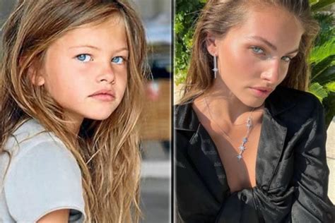 thylane blondeau bikini|'Most beautiful girl in the world' back from surgery in a bikini.